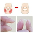 thumbnail image 4 of Kit para el cuidado de los pies de la herramienta de recuperación de los pies Abanopi Herramientas de cuidado de uñas, 4 of 5
