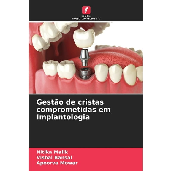 GestÃ£o de cristas comprometidas em Implantologia, (Paperback)
