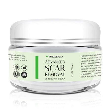 Scar Removal Cream - Advanced Treatment for Face & Body, Old & New Scars from Cuts, Stretch Marks, C-Sections & Surgeries - With Natural Herbal Extracts Formula - (30 (Best Cream For C Section Scar)