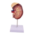 thumbnail image 3 of Modelo de riñón humano, herramienta , modelo de disección educativo para aprendizaje de ciencias en aula para adultos., 3 of 9