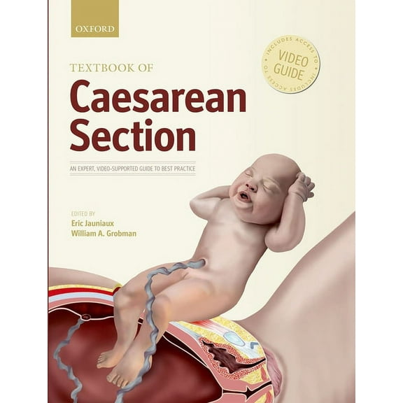 Textbook of Caesarean Section, (Hardcover)