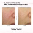 thumbnail image 2 of Loción Physiogel Calming Relief Relief Reductor de Enrojecimiento 30 ml, 2 of 7