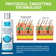 thumbnail image 4 of Champú Roycederm para psoriasis, dermatitis seborreica, 200 ml, 4 of 9