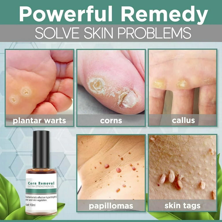 Best hard skin removers for your feet in 2023 reviewed