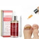 thumbnail image 2 of Esencia natural reparadora Sincero tratamiento antifúngico 15 ml, 2 of 10