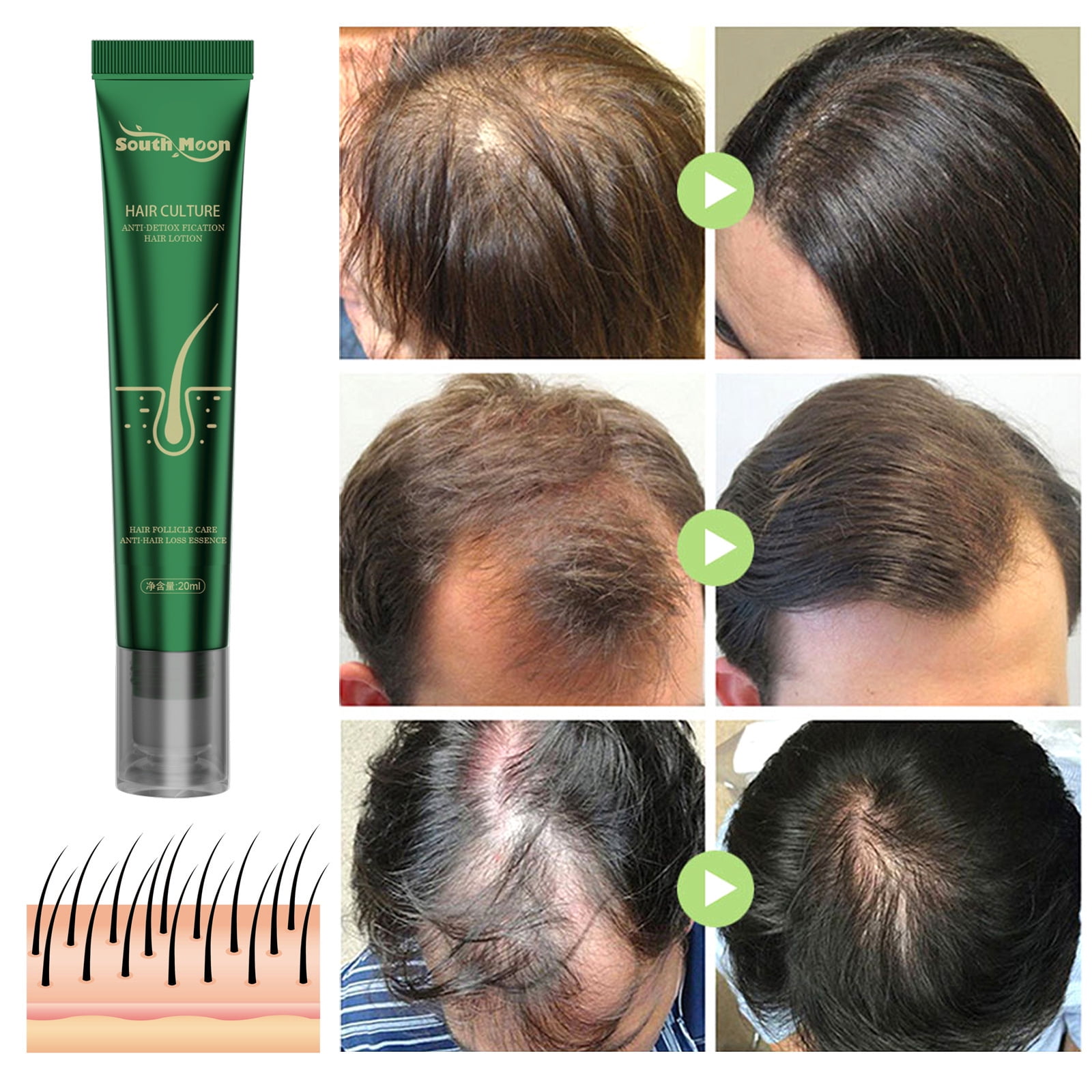 Buy Hair Growth Drops Rosemary Oil, Peptides & Minoxidil Hair Loss