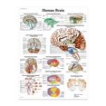 thumbnail image 1 of Anatomical illustration of the human brain poster, canvas, large size. For classrooms, clinics, hospitals, doctors' offices, 1 of 4