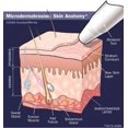 thumbnail image 4 of Cristales para microdermoabrasión Need Crystals, paquete de 2 unidades, 2,72 kg, 120 granos, 4 of 5