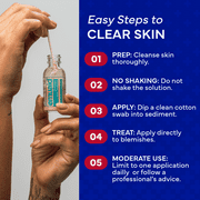 Emuaid Overnight Acne Treatment with Sulfur and 2% Salicylic Acid, 1 oz