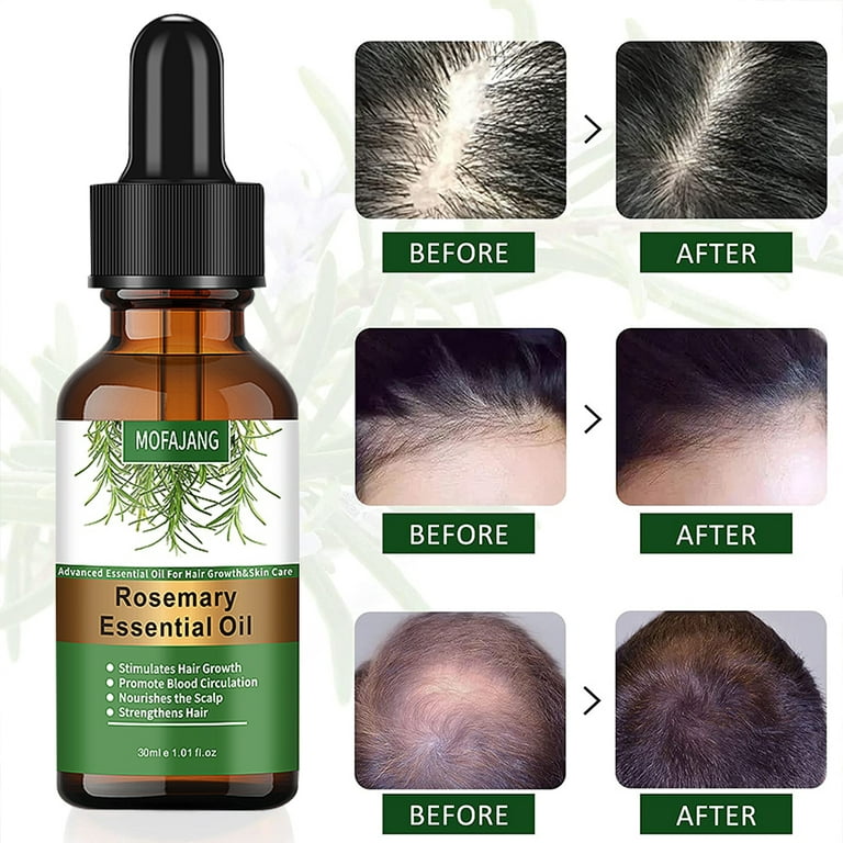 2pcs Rosemary Essential Oil, Rosemary Hair Growth Oil for Hair Loss Regrowth Treatment, Pure Natural Stimulates Hair Growth, Improves Blood