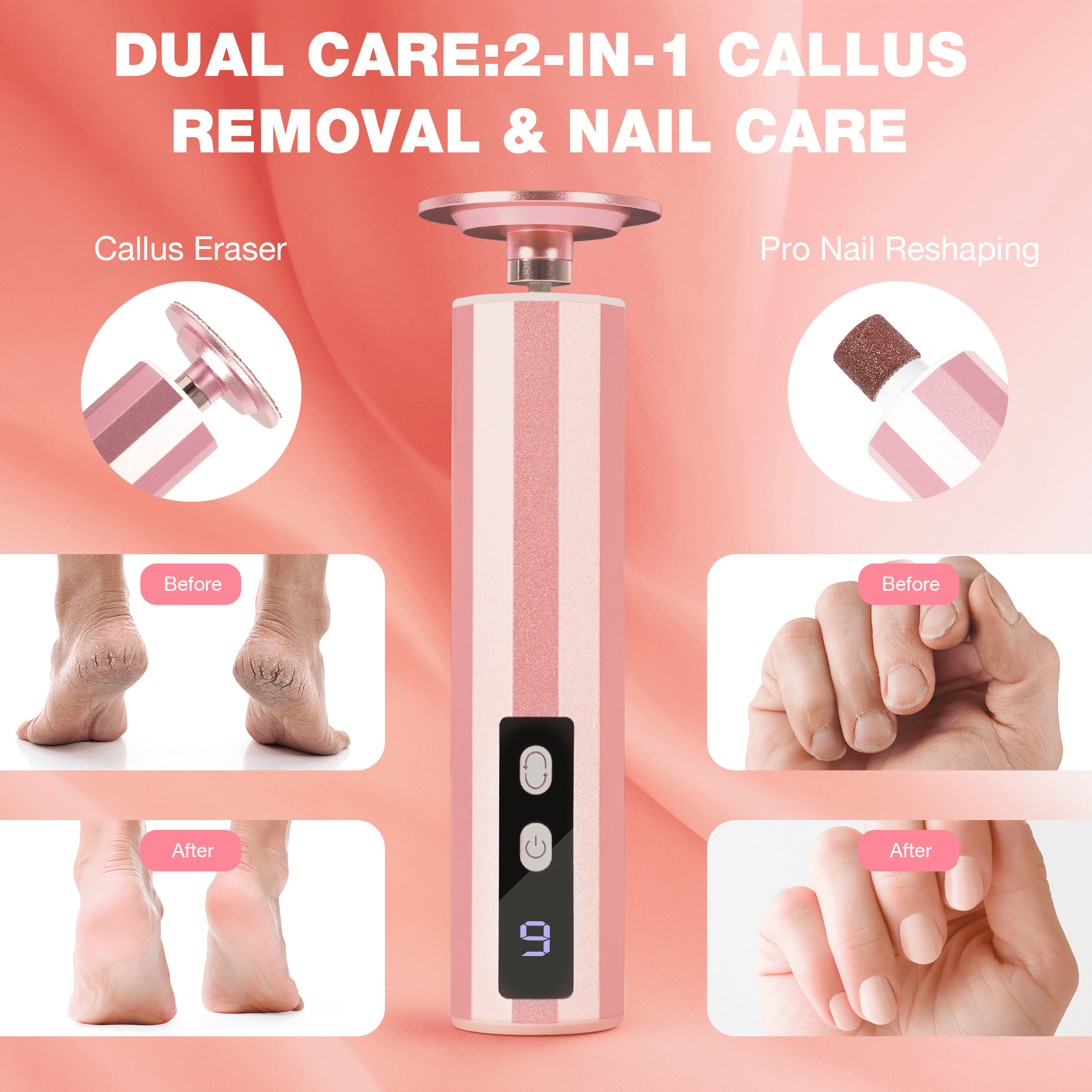 FETERVIC Electric Foot File - Callus Remover Nail Filer for Feet,9 Adjustable Speed Foot Scrubber Pedicure Tool for Dead Skin and Calluses Gift- Pink