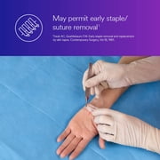 3M Skin & Wound Closure Strips - Reinforced & Sterile Adhesives for Fast Wound & Cuts Healing with Minimal Scarring, Infection Prevention from Suture & Stample Removal - 6mm x 38mm - Pack of 5
