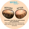 thumbnail image 2 of Cepillo limpiador de párpados Mybo Clean para pieles sensibles, 2 of 9