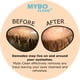 thumbnail image 2 of Cepillo limpiador de párpados Mybo Clean para pieles sensibles, 2 of 9