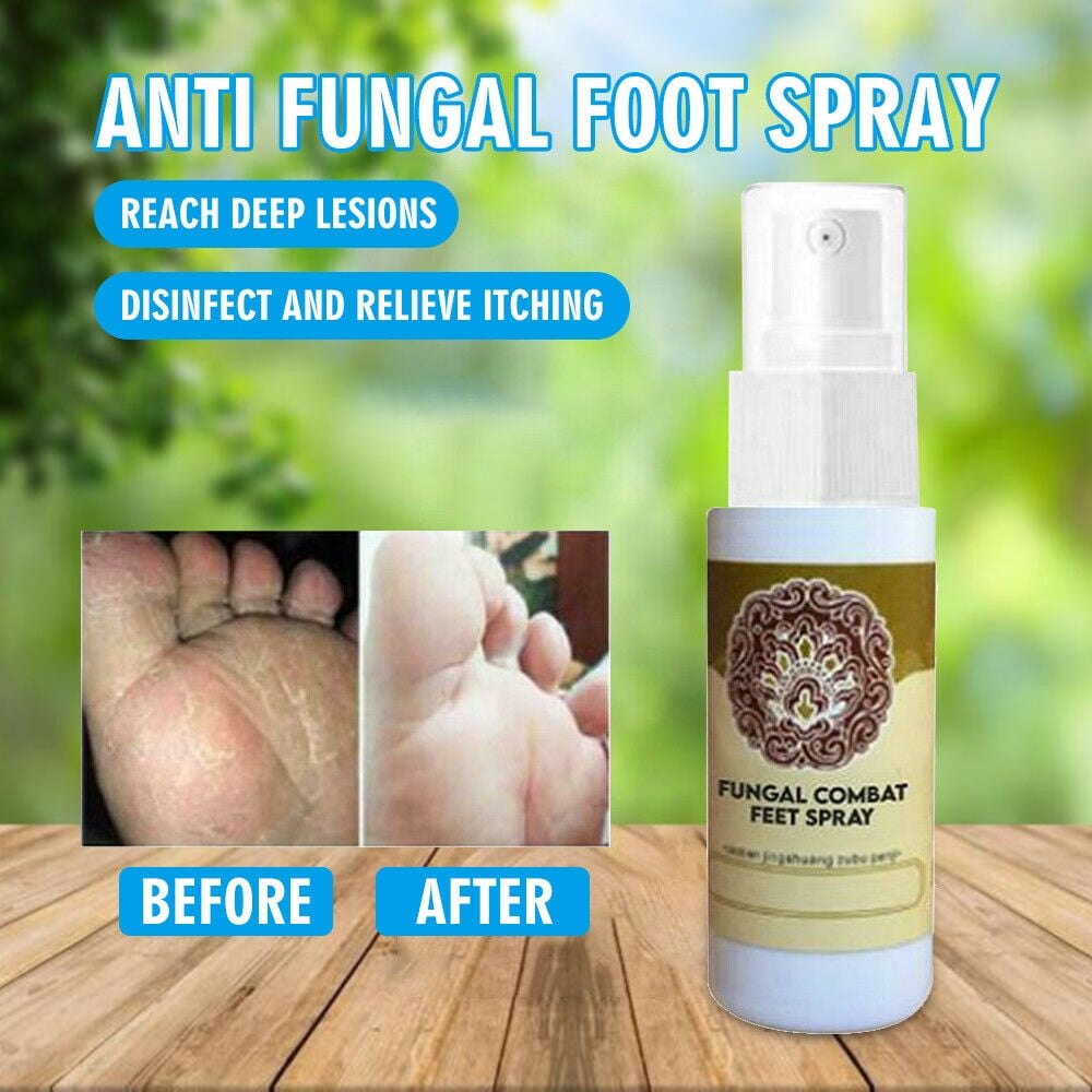 Natural Herbal Fungus Combat Feet Spray Anti Fungal Infections Athlete