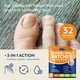 thumbnail image 2 of Tratamiento para hongos en las uñas de los pies VigorWell Overnight Renewal (32 unidades), 2 of 8