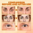 thumbnail image 5 of Suero para ojos con péptidos de miel. Hidrata, ilumina, reduce bolsas y ojeras, repara y reafirma la piel del contorno de ojos., 5 of 5