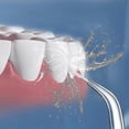 thumbnail image 5 of 6-Pack Replacement Tips for Water Flosser Compatible with Various Oral Irrigation Devices, 5 of 5