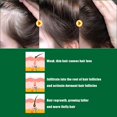 thumbnail image 4 of Aceite esencial de jengibre para el cabello anticaída serum tratamiento para la caída del cabello y adelgamiento promueve la regeneración del cabello unisex CAIXIN Jengibre cuidado del cabello aceite esencial, 4 of 6