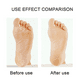 thumbnail image 4 of Herramienta para el cuidado de los pies, exfoliante en forma de gota, exfoliante para pies, polvo transparente Adepaton CPB-US-YYM237-2, 4 of 5
