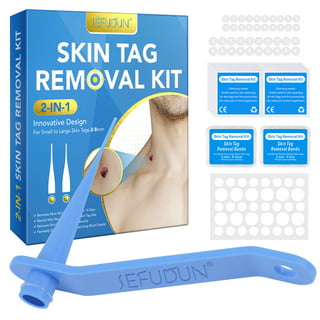 Skin tag Remover Pen, Mole and Wart Removal from home – Balma Home
