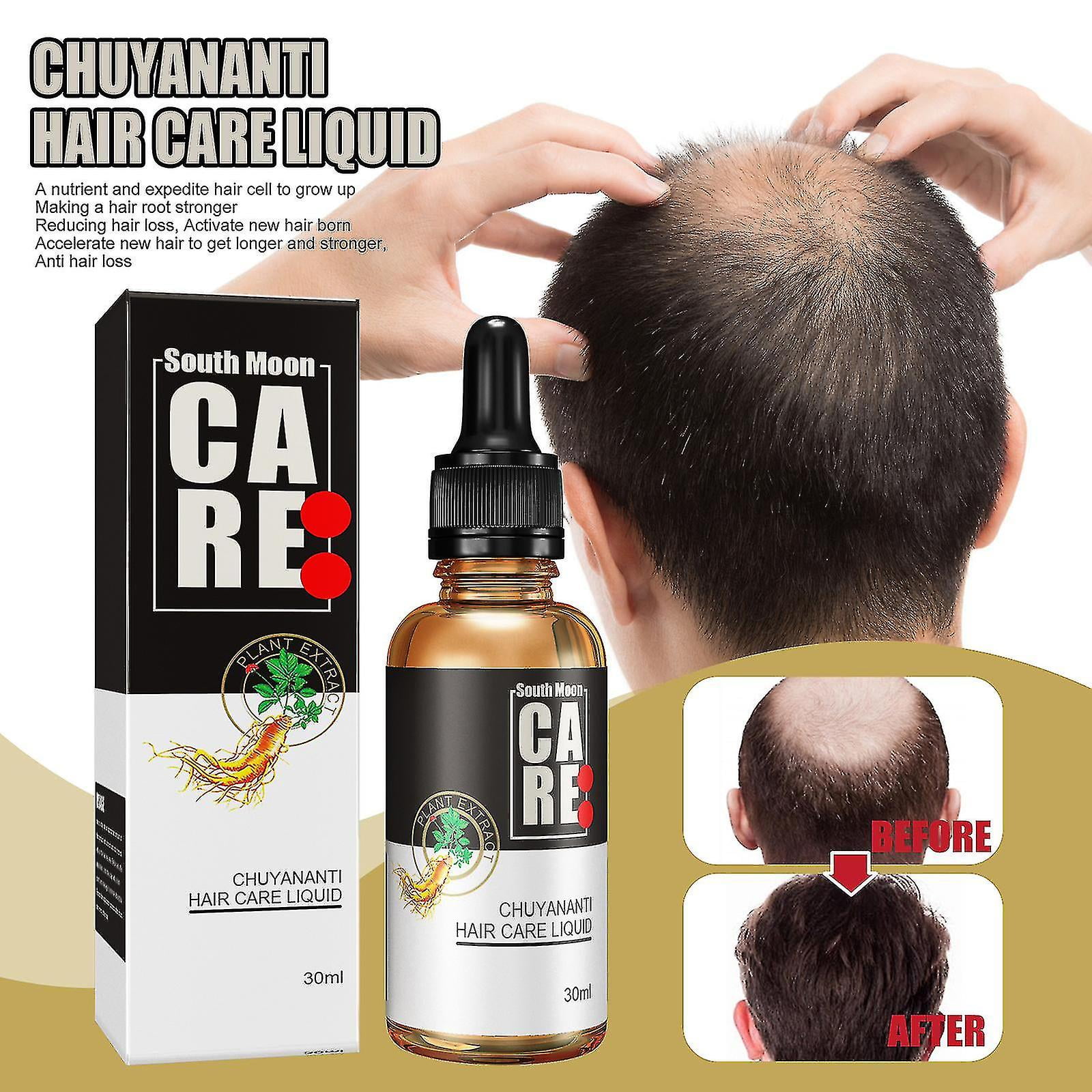 Anti-falling Conditioner Essential Oil Moisturizes Hair Roots, Strengthens, Prevents Broken Hair, Densifies, And Consolidates Hair Growth A | Walmart Canada Anti-falling Conditioner Essential Oil Moisturizes Hair Roots, Strengthens, Prevents Broken Hair, Densifies, And Consolidates Hair Growth A | Walmart Canada