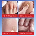 thumbnail image 4 of Crema para manos y pies | Tratamiento intensivo hidratante para reparación de talones | Cuidado para piel seca y agrietada con aloe y manzanilla | Suaviza manos, talones y codos ásperos | No grasa, 4 of 9