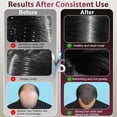 thumbnail image 3 of 3-in-1 Hair Growth Comb for Men with 630nm Red Light Therapy, Scalp Massager Brush, Oil Applicator, 72 Teeth & 8 Roller Balls, USB-C Rechargeable, Waterproof Anti Hair Loss Device, 3 of 7