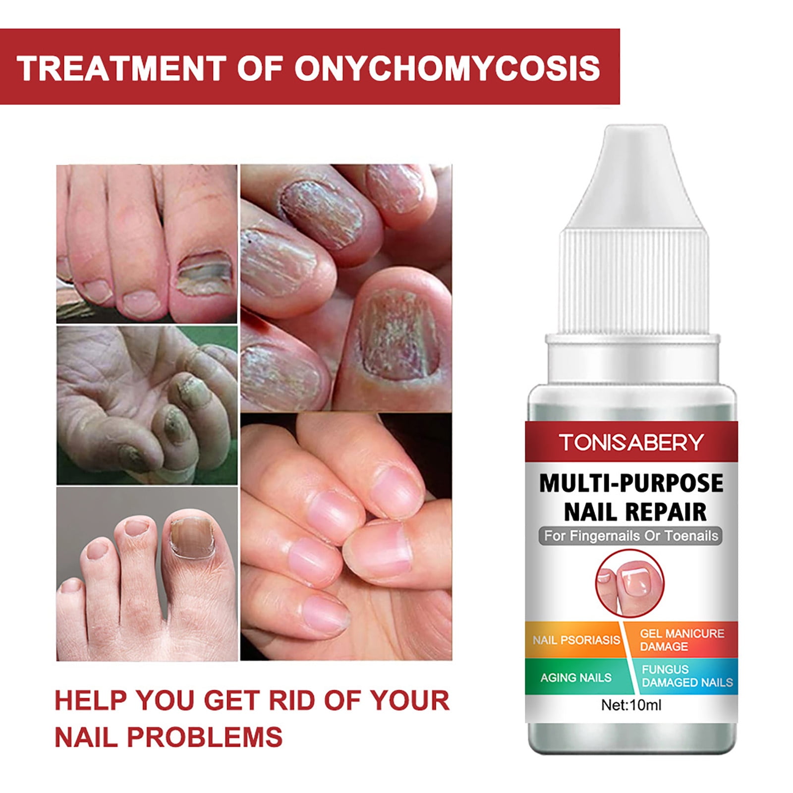 Say goodbye to 9 common nail problems with our Nails 9 in 1 Complex by  Revuele! 💅✨ This professional nail formula is your one-stop... | Instagram