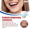 thumbnail image 3 of Sp 6 Toothpaste, Sp-6 Toothpaste, Ultra Whitening Toothpaste Sp-6, Sp-6 Probiotic Brightening Whitening Toothpaste, Fresh Breath, 3 of 5