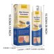thumbnail image 2 of Líquido calmante e hidratante para psoriasis, líquido portátil antipicazón, líquidos para el cuidado corporal, suministros para el cuidado corporal13.9513.95, 2 of 5