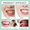thumbnail image 3 of El parche dental de gel para mascarilla dental elimina fácilmente los dientes amarillentos rápidamente. Elimina las manchas y mejora el aliento. Ofrece una limpieza fresca, delicada y profunda. Una pa, 3 of 3