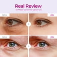 thumbnail image 3 of Parche para ojos Dr.Melaxin Calcium Volume, 60 parches, 3 of 6