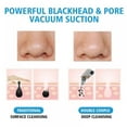 thumbnail image 5 of Clearance! Blackhead Remover Pore Vacuum - Electric Blackhead Removal tool facial Pore Cleaner Extractor Beauty Device kit with 5 Suction Heads for Women and Men, 5 of 6