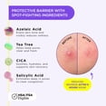 thumbnail image 4 of Pimple Patch ZitSticka UNDERCOVER Liquid con ácido salicílico, 4 of 8