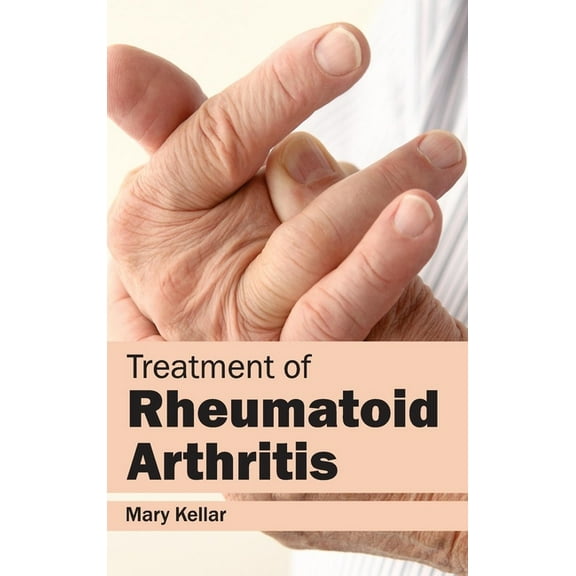 Treatment of Rheumatoid Arthritis, (Hardcover)