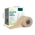 3 Meters Silicone Scar Stickers to Reduce Itching and Redness Scar