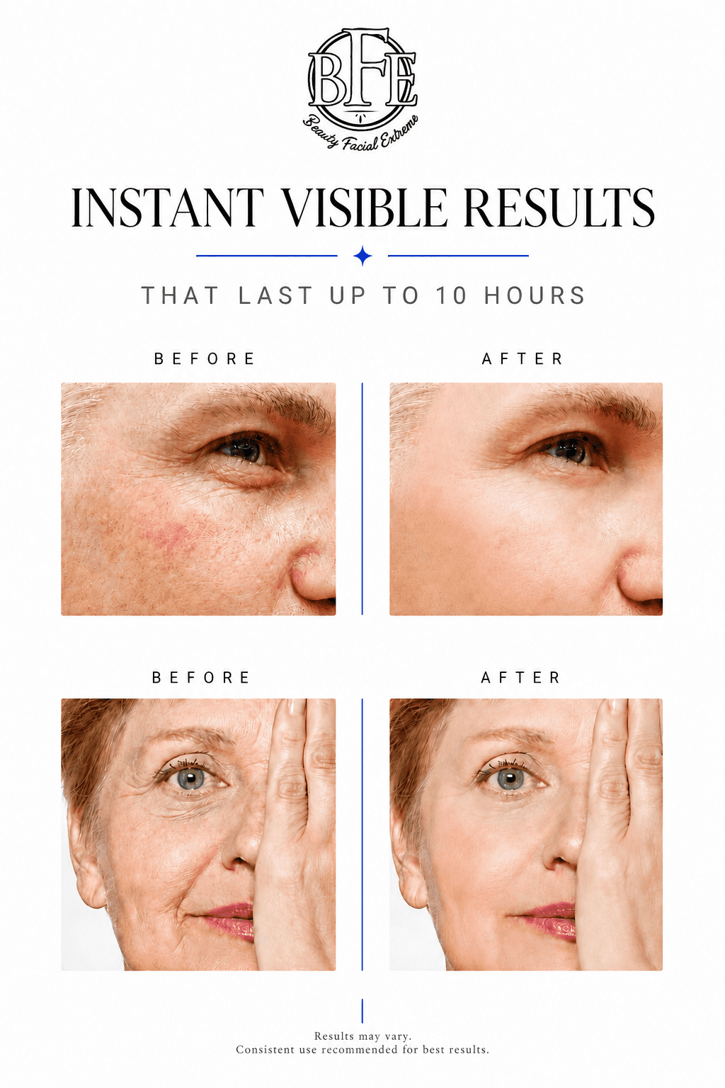 Instant Eye Tightener Cream - Reduces Under Eye Puffiness, Bags, Dark Circles. Lift Technology to Tighten & Firm Sagging Skin Around Eyes. Smooths Away Crow’s Feet, Fine Lines & Wrinkles.