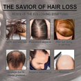 thumbnail image 4 of Rose Mary Oil For Hair Growth Skin Care, Nourishment Scalp, Stimulates Hair Growth, Improves Blood Cir, 4 of 5