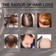 thumbnail image 4 of Rose Mary Oil For Hair Growth Skin Care, Nourishment Scalp, Stimulates Hair Growth, Improves Blood Circulation 30ml -, 4 of 5