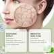 thumbnail image 4 of Esencias Calmantes y Reparadoras de Centella Asiática 30 Ml | Extracto de Hierba de Nieve | Ácido Hialurónico | Componentes Antioxidantes | Suave y No Irritante, 4 of 7