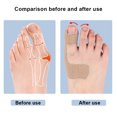 thumbnail image 4 of Herramienta Cuidado Del Pie Auto Adhesivo Los Pies Del Dedo Del Pie La Punta 10pcs Bunion (beige), 4 of 5