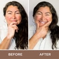thumbnail image 2 of Kit de camuflaje cosmético Fake Bake Vitiligo Vanquish, 2 of 6