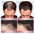 thumbnail image 5 of 3Pcs Zephta H-Regrow 2.0, Zephta Hair Regrowth, Prorevita Rice Nutri Spray, for Hair, 5 of 5