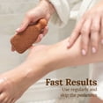 thumbnail image 3 of Gilden Tree Foot File, Lasts 5+ Years, Callus Remover Pumice Stone Scrubber for Feet, 3 of 9