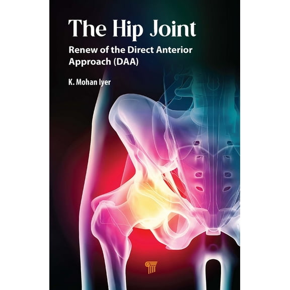 The Hip Joint: Renew of the Direct Anterior Approach (DAA), (Paperback)