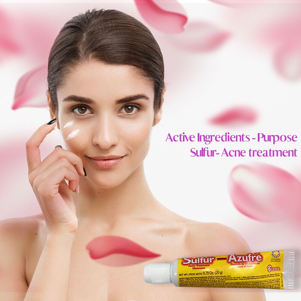 sulfur acne treatment