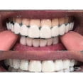 thumbnail image 1 of Upper/lower Comfort Fit Flex Whitening Denture Braces, 1 of 4