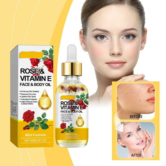 Riforla Rose Vitamin E and Moisturizing Oil Nourishes The Body Reduces and Stretch Marks and Improves Skin Elasticity 60ML Personal Skin Care Orange