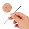 thumbnail image 5 of 4PCS/Set Stainless Steel Blackhead Acne Blemish Removal Needle Kit Tool, 5 of 5